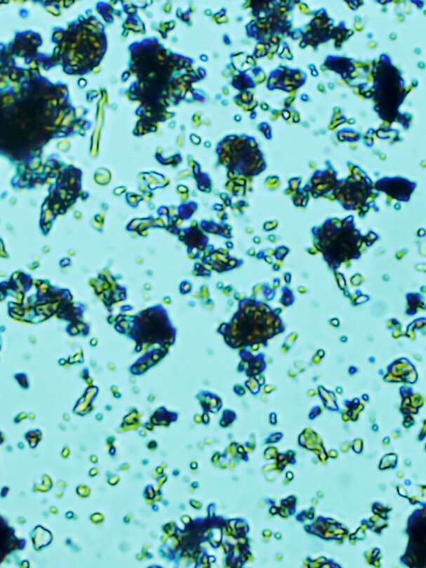 Prostatakarzinom Symposium